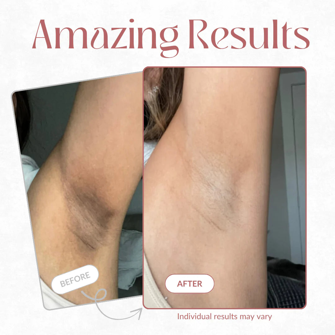 Bellaluny Peel-Shot Spray™