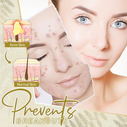 ActiveSkin™ Line Rewind 24K Gold Serum