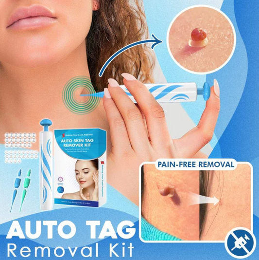 Auto Tag Rapid Removal Kit