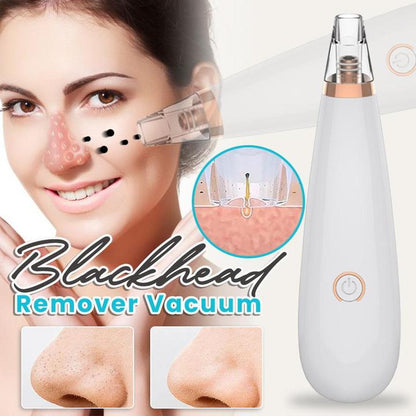 Blackhead Remover Vacuum