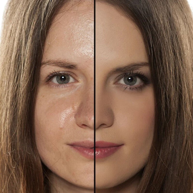 Olie-absorberende vulkanische gezichtsroller